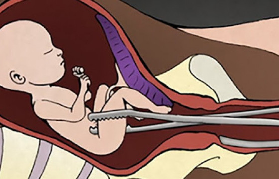 Жилд 4000 орчим өсвөр насны охин амарждаг