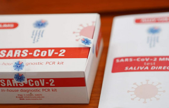 Шүлснээс коронавирус илрүүлэх оношлуур нэвтрүүлнэ  