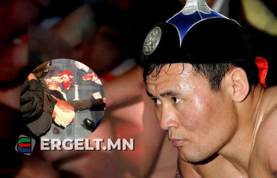 Э.Энхбат начин ухаангүй 40 хонож байна