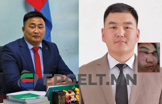 Хөвсгөл аймгийн БОАЖГ-ын дарга Г.ЭНХБАЯР: Би ч бас зодуулсан гэхдээ өөрийнхөө зургийг цахим орчинд нийтэлмээргүй  байна