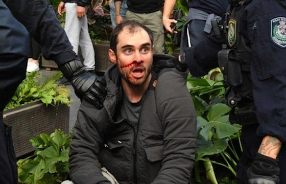 ФОТО: Австралид хөл хориог эсэргүүцэж, жагсаал зохион байгуулсан иргэдийг баривчилжээ