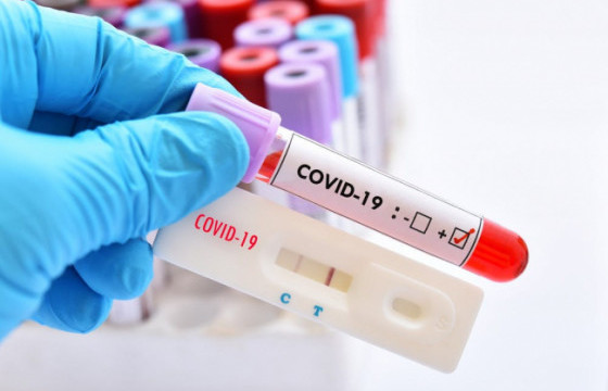 ЭМЯ: 3638 хүнээс коронавирусийн халдвар илэрч, гурван иргэн нас баржээ