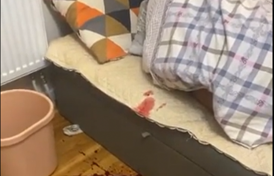 Цусаар бөөлжиж, биеийн байдал нь хүнд байсан иргэнийг эмнэлэгт хэвтүүлжээ