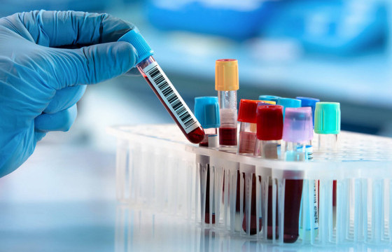 Монголд гепатитын В, С вирусийн халдварын тархалтыг таслан зогсоосныг баталгаажуулах урьдчилсан үнэлгээг хийнэ