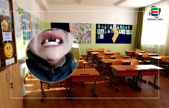 ХҮҮГИЙН АР ГЭР: Наймдугаар ангийн хүүгийн минь дөрвөн шүдийг ангийнх нь хүүхэд хугалсан. Ангийн багш нь “Цалингаа хасуулж чадахгүй, хичээлд нь явуул” гэсэн