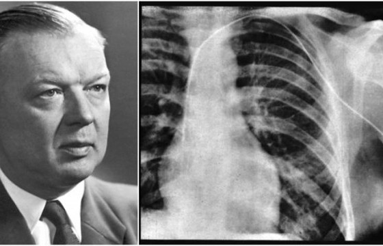 СОНИРХОЛТОЙ ШИНЖЛЭХ УХААН: Зүрх цоолох туршилт хийсэн эрдэмтэнд Нобелийн шагнал олгожээ