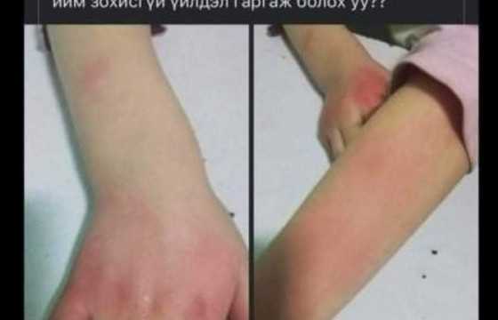 97 дугаар сургуулийн захирал Б.Алтанцэцэг: Сурагчаа зодсон гэх багш 