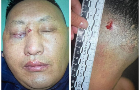 Жагсаалын үеэр бэртсэн цагдаагийн алба хаагчдын зураг ил боллоо