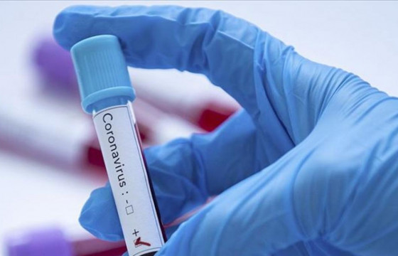 ЭМЯ: Шинээр короновирусын 89 халдвар илэрлээ