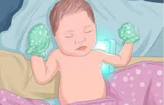 Т.БОЛОРМАА: Гүйцэт төрсөн нярайн 60 хувь, дутуу төрсөн нярайн 80 хувьд шарлалт илэрдэг