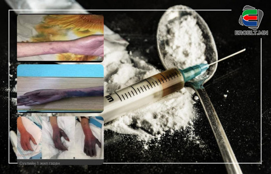 Эм гар аргаар найруулж судсаар тарьснаас болж таван иргэн нас баржээ