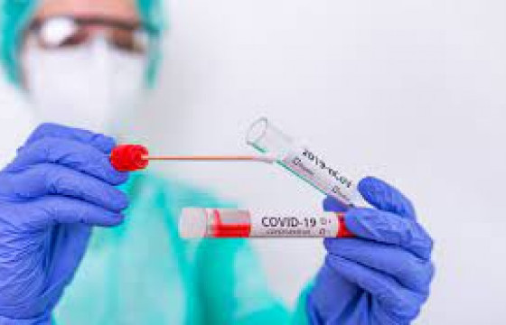 Өнгөрсөн хоногт 153 хүнээс коронавирусийн халдвар илэрчээ