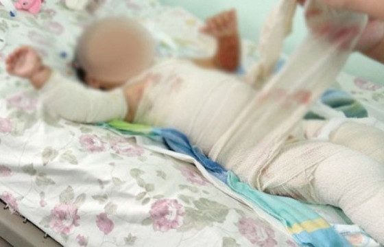 Түлэнхийн сорвитой 100 хүүхдэд үнэ төлбөргүй үзлэг хийнэ