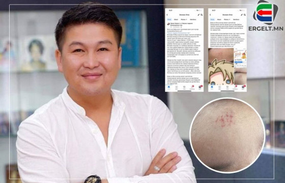 Жүжигчин А.Энхжин: “ОЮУНЫ ЧАДАМЖ БОЛОВСРОЛЫН ТӨВ”-ИЙН БАГШ СОГТУУРСАН ҮЕДЭЭ ДОЛООН НАСТАЙ ХҮҮГ МИНЬ ЗОДОЖ, ГЭМТЭЭСЭН Ч ЦАГДАА НАР АРГА ХЭМЖЭЭ АВАХГҮЙ БАЙНА