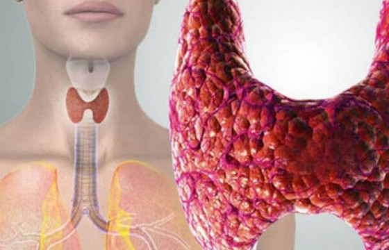 Бамбай булчирхайн хорт хавдрын тусламж, үйлчилгээг ЭМД-ын сангаас бүрэн хариуцна