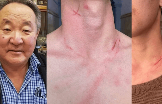  Ж.СОЛОНГО: “Намайг оюутнаа зодсон” хэмээн хэрэг бүртгэл нээж, цагдаагийн байгууллагаас шалгаагүй