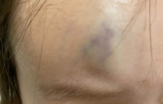 ЦЕГ: БАГШДАА ЗОДУУЛСАН ГЭХ ОХИНЫ ГЭМТЛИЙН ЗЭРГИЙГ ТОГТООЖ, ХЭРЭГ БҮРТГЭЛ НЭЭНЭ