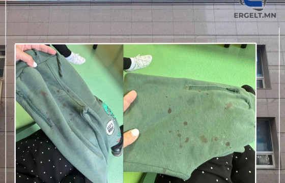 Ж.БАТЧИМЭГ: Нийслэлийн 309-р цэцэрлэгийн багш Д дөрвөн настай хүүхдийг минь нуруу болон хамар руу нь цохиж, удаа дараа зодсон