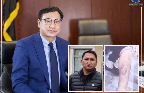 Б.ГАНХУЯГИЙН ХҮРГЭН АХ Д.ПҮРЭВДОРЖ: Дүүгийн минь биеийг зориудаар хордуулсан байж болзошгүй 