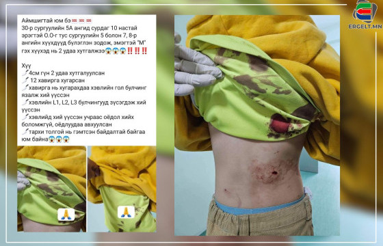 30-Р СУРГУУЛИЙН ЗАХИРАЛ: Манай сургуулийн сурагч 97-р сургуулийн сурагчтай хичээл тарсны дараа зодолдож, нэгнээ гэмтээсэн байна