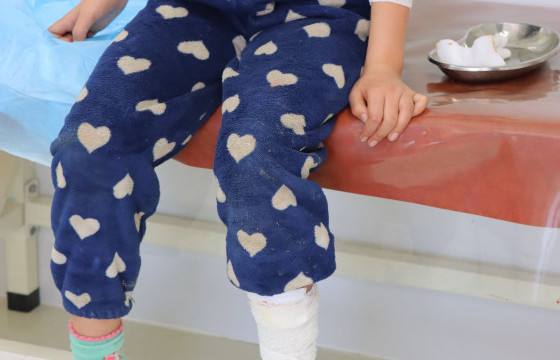 НЭМГ: 5-9 насны хүүхдүүд нохойд хазуулж гэмтэх тохиолдол өндөр байна