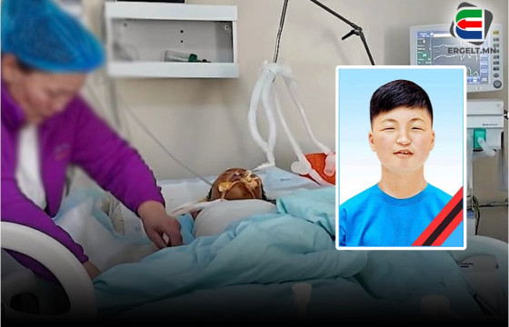 ГАЛД ӨРТСӨН ХҮҮХДҮҮДИЙН ЭМЭЭ: ДҮРЭЛЗСЭН ГАЛААС ДҮҮГЭЭ АВРААД, АМИА АЛДСАН ХҮҮГЭЭ БОДОХООР ӨР ЗҮРХ ШИМШРЭЭД БАЙХ ЮМ